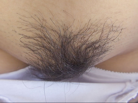 300人のまん毛3　サンプル画像11